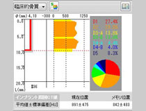 インプラント治療